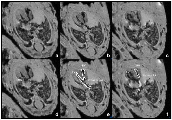 Fig. 5