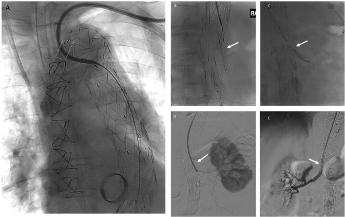 Fig. 4