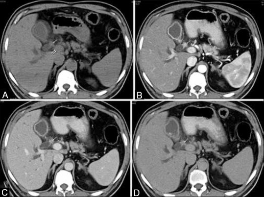 Figure 4 (A-D)