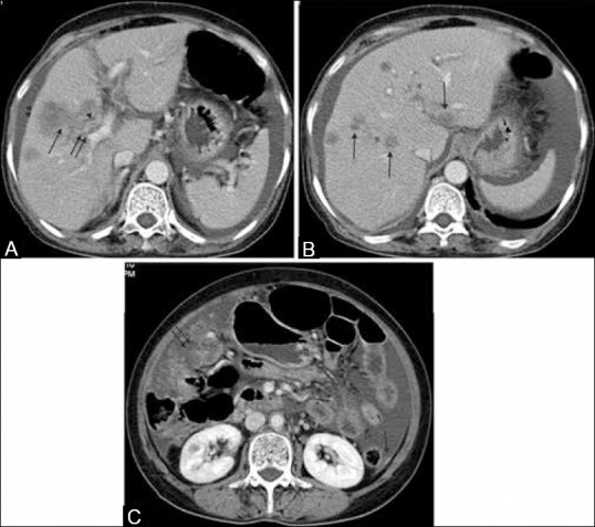 Figure 13 (A-C)