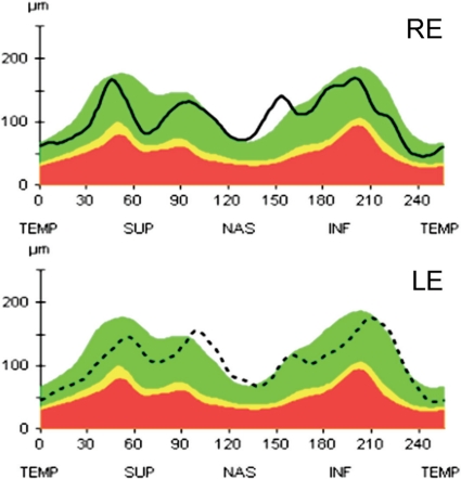 Fig. 3