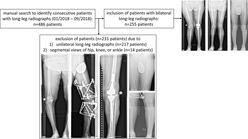 Flowchart to indicate patient numbers after manual search of the database and after application of inclusion and exclusion criteria.