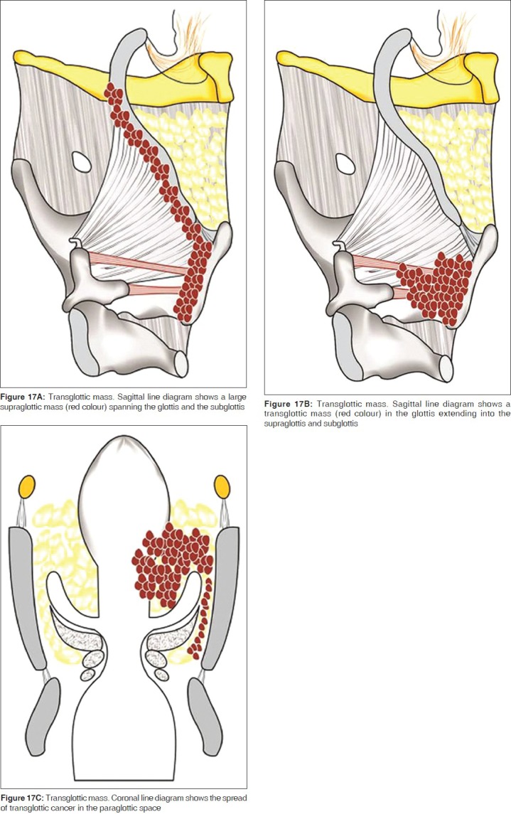 Figure 17