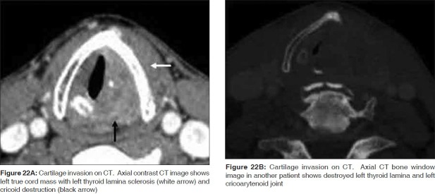 Figure 22