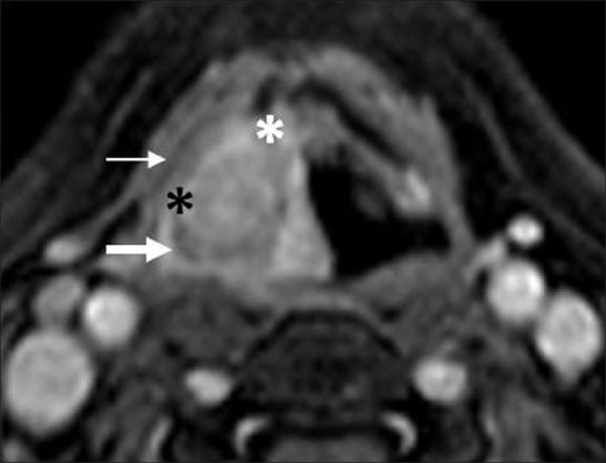 Figure 21