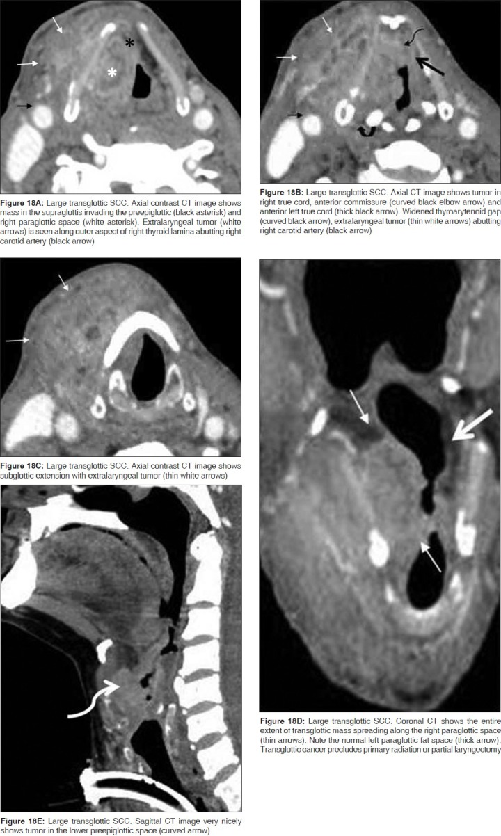 Figure 18