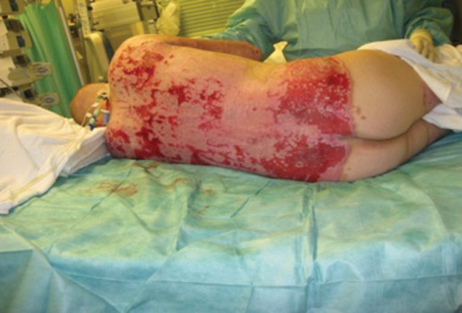 IWJ-12650-FIG-0008-c