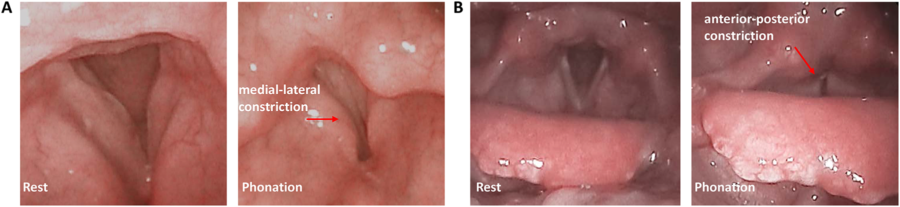 Figure 3: