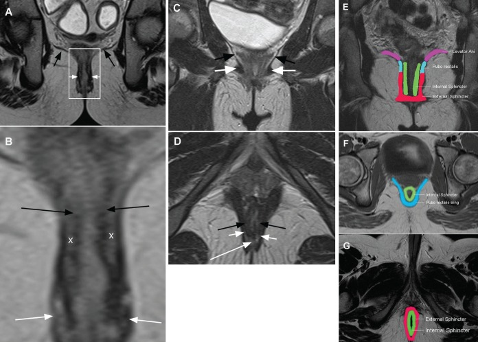 Figure 3)