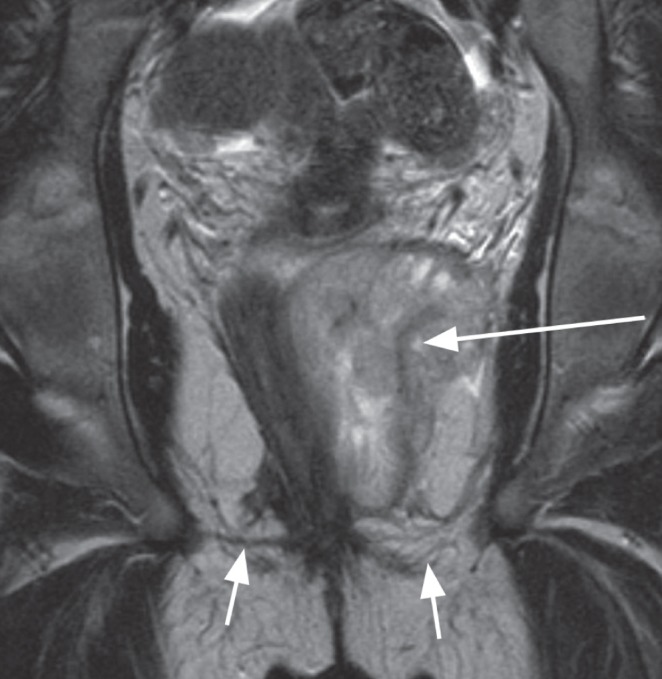 Figure 9)