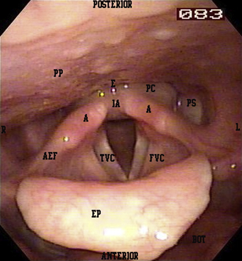 Fig. 1