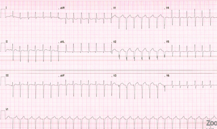 FIGURE 1