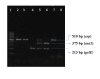 Figure 1.Agarose gel electrophoresis of amplified asa1, esp and gelE by multiplex PCR.