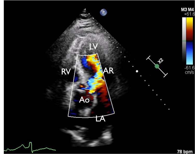 Figure 4