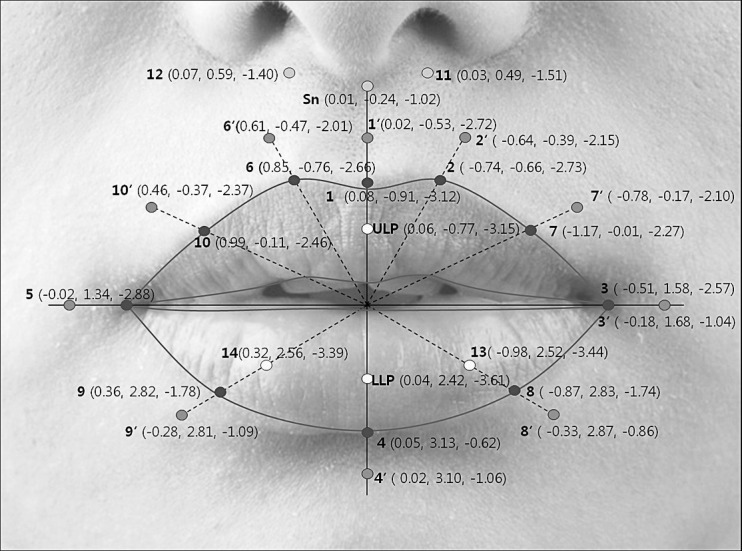 Figure 5. Overall 3D changes of soft tissue landmarks after orthodontic treatment with extraction of all four first premolars. Shown as: (changes in the x-axis, y-axis, and z-axis).