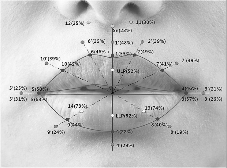 Figure 6. The relative ratio of the amount of soft tissue movement in the z-axis to that of the incisal tip movement in the anteroposterior direction.