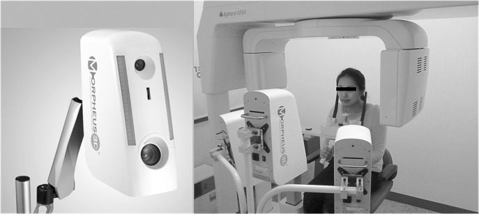 Figure 1. The structured light scanner (Morpheus 3D) used in this study and equipment setting scanned from three different views simultaneously.