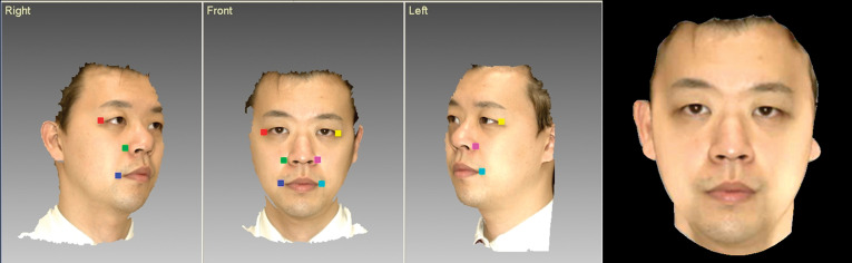 Figure 2. Reconstruction of 3D face by automatic registration analyzing the geometry of six selected circumjacent points.