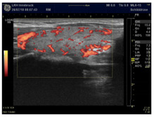 graphic file with name diagnostics-12-00107-i001.jpg