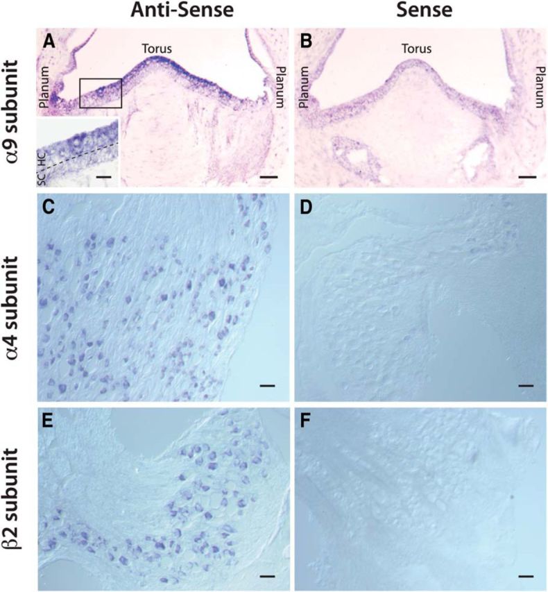 Figure 11.