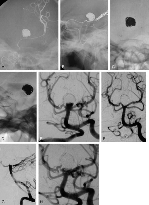 Fig 2.