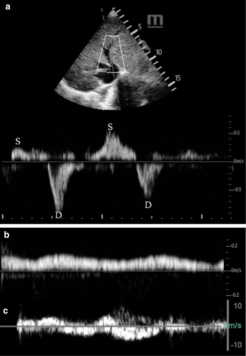 Fig. 3