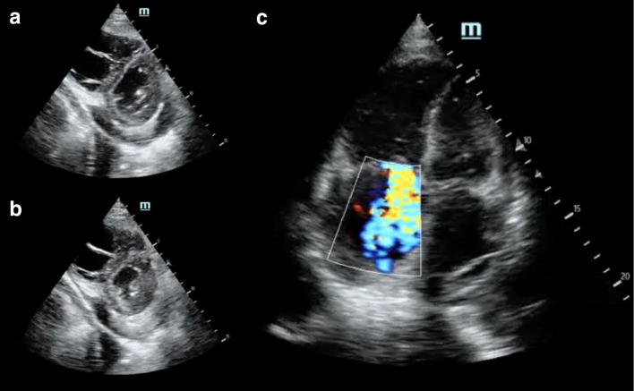 Fig. 2