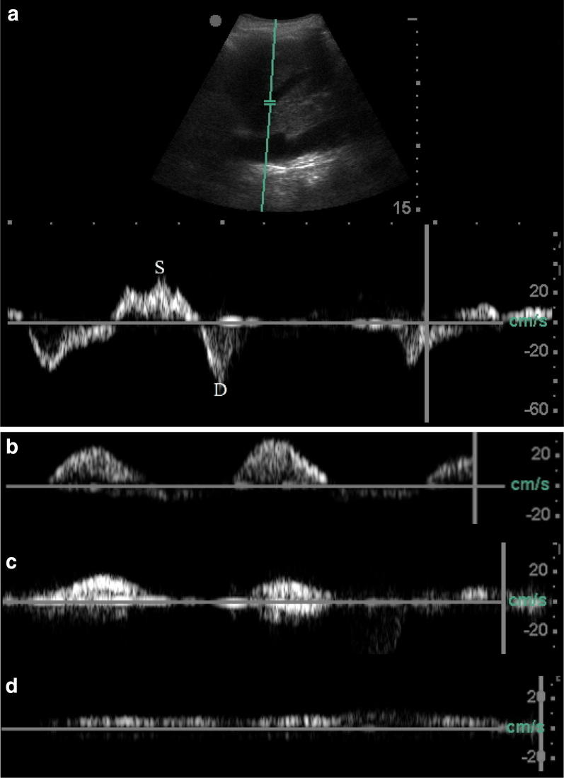 Fig. 1