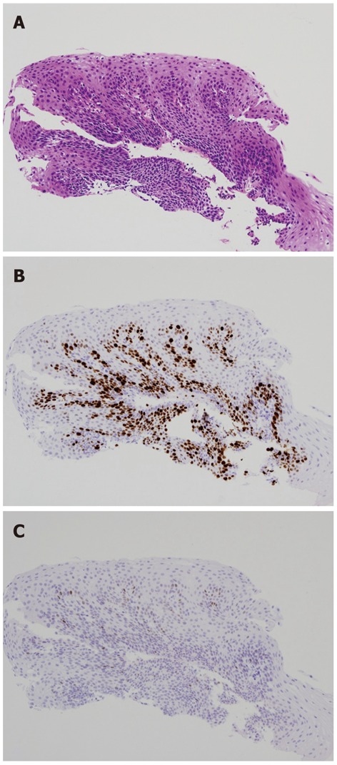 Figure 14