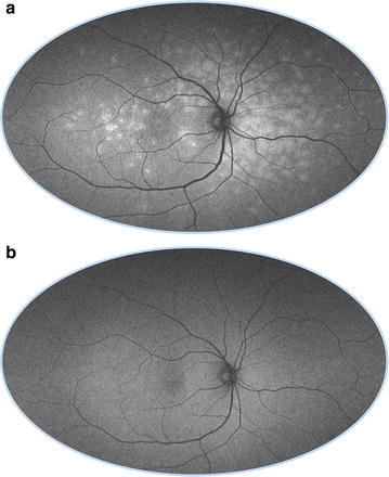 Fig. 13