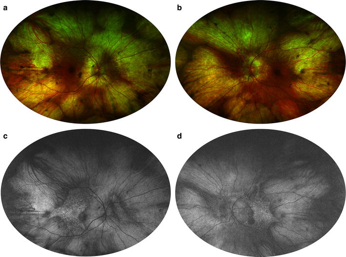 Fig. 11