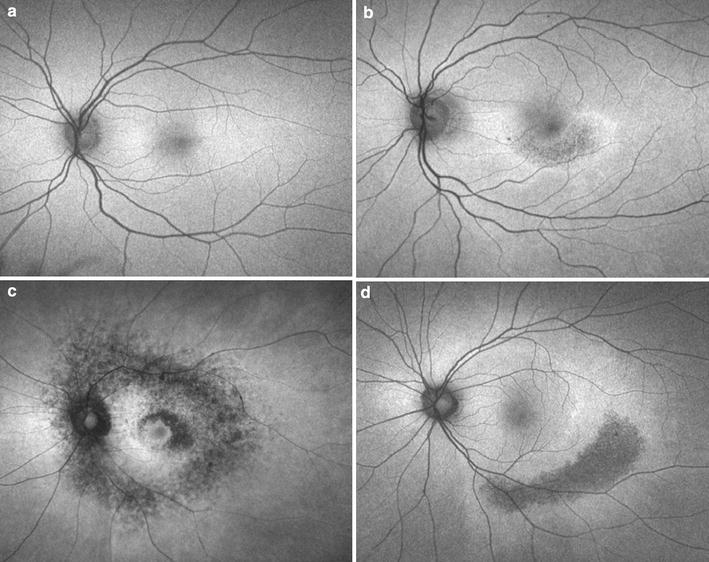 Fig. 14