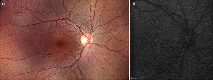 Fig. 12