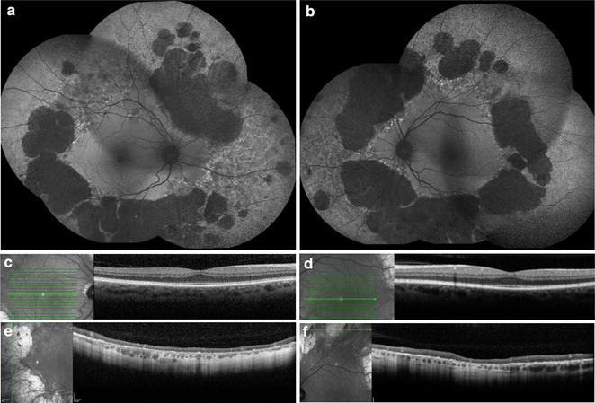 Fig. 15