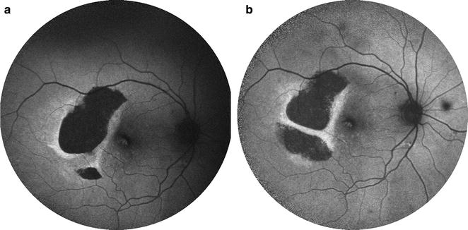 Fig. 7