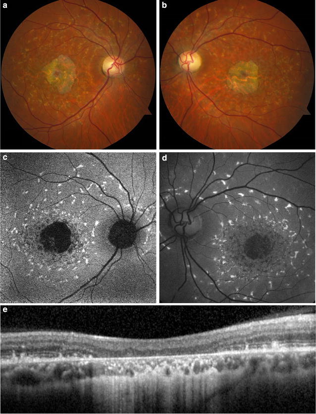 Fig. 9