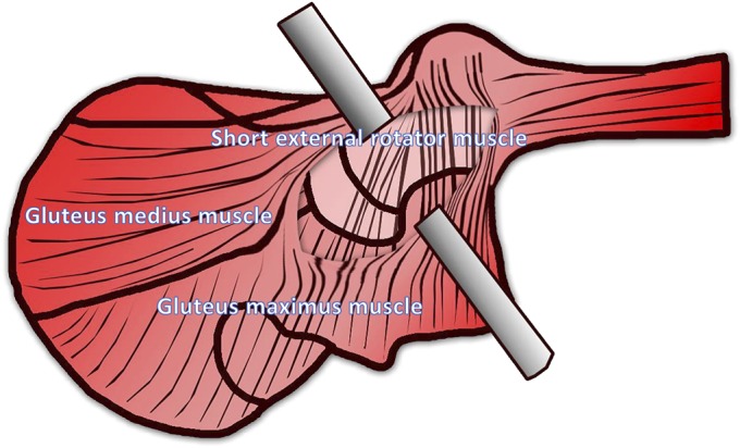 Fig. 1-A