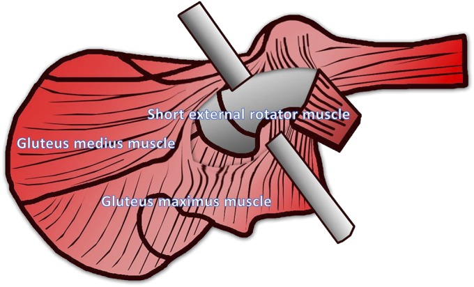 Fig. 1-B