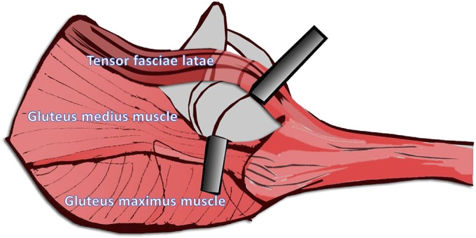 Fig. 3-B