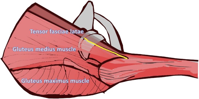 Fig. 3-A