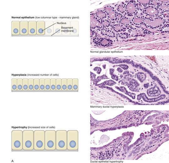 Figure 1-25