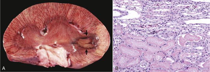 Figure 1-17