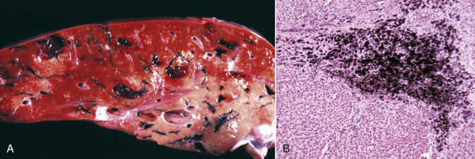 Figure 1-52