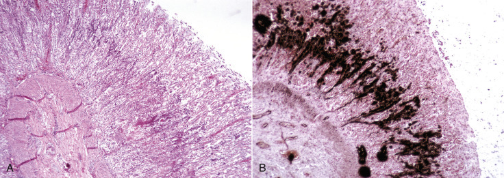 Figure 1-39