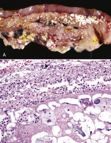 Figure 1-21