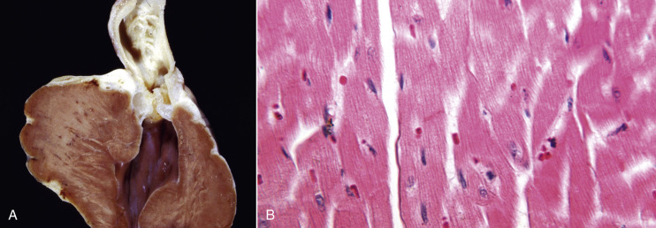 E-Figure 1-13