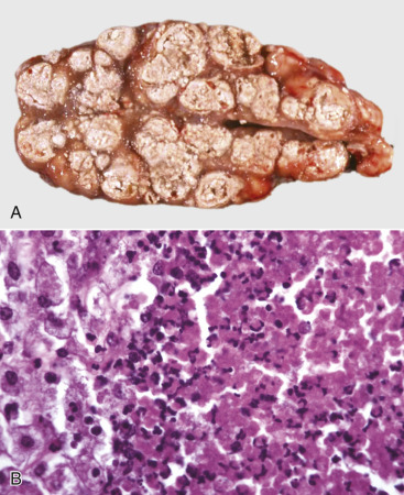 Figure 1-18