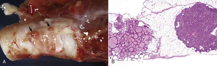 Figure 1-26