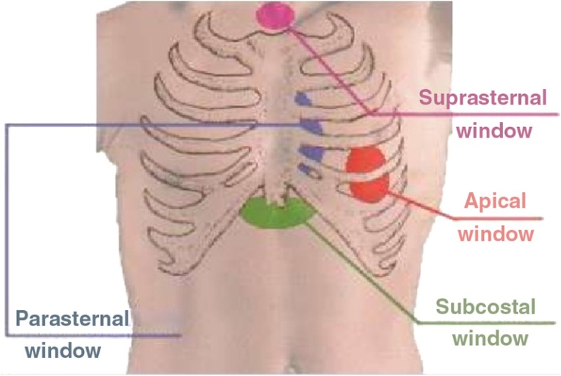 Fig. 2