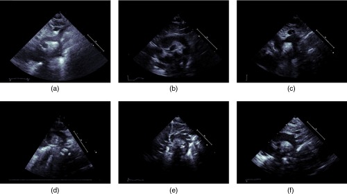 Fig. 10